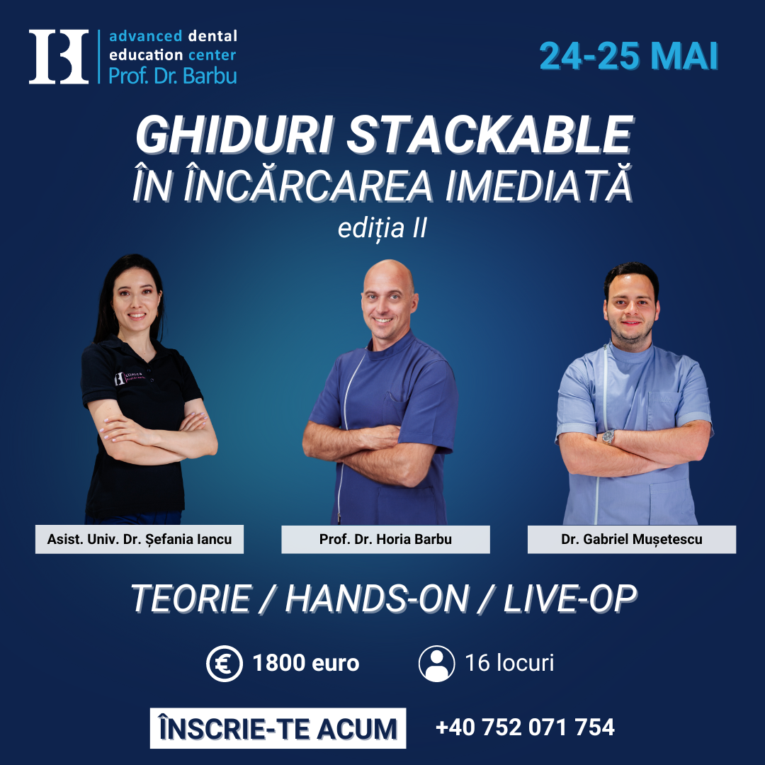Ghiduri Stackable în încărcarea imediată